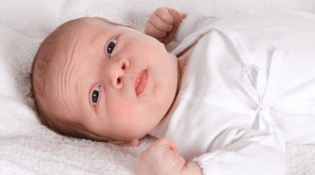 baby with Retinopathy of prematurity (ROP)