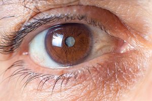 person glaucoma growth over the eye