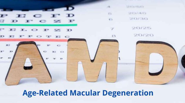 Macualr Degeneraton tiles