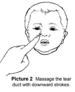Tear Sac massage